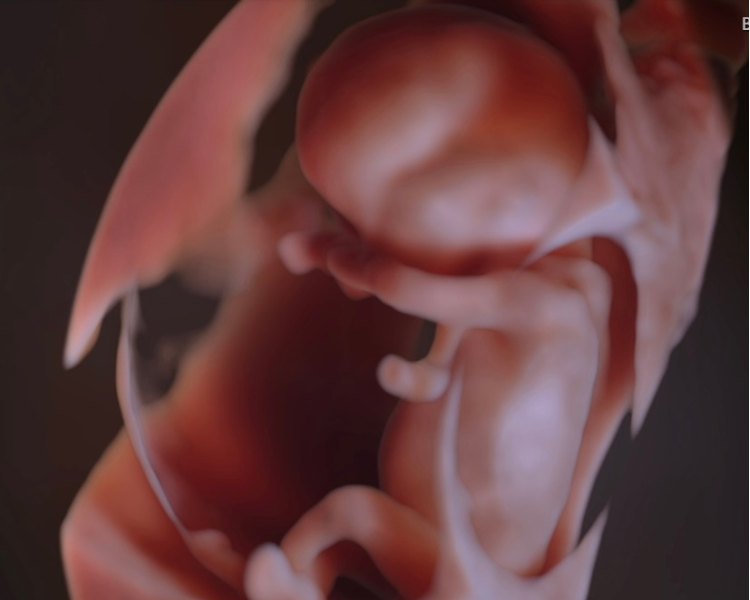 ultrasonido fetal