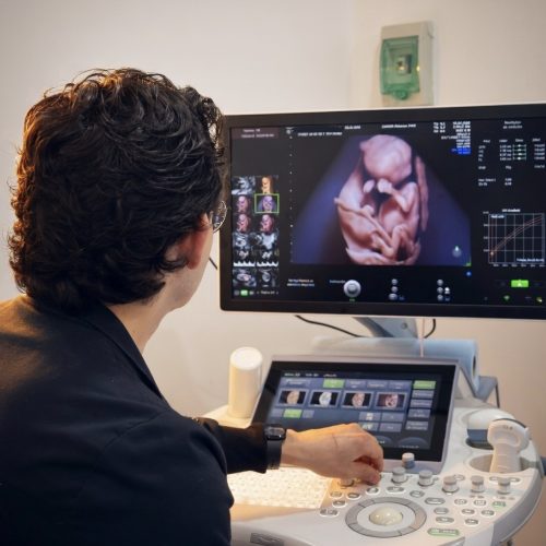 Ultrasonido dr